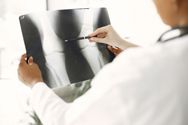 Can You Reverse Bone Loss Without Medication? A Physio’s Take on Building Back Strength