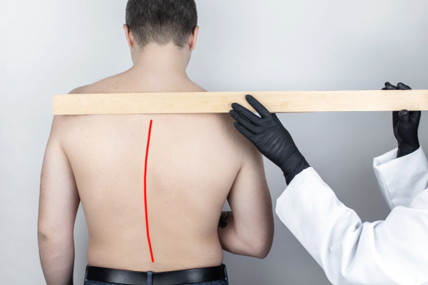 Lordosis Symptoms in Teenagers: Early Warning Signs Parents Should Know
