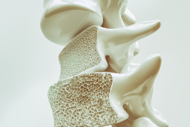 How to Prevent Osteoporosis After 35: Diet, Exercise, and Lifestyle Tips