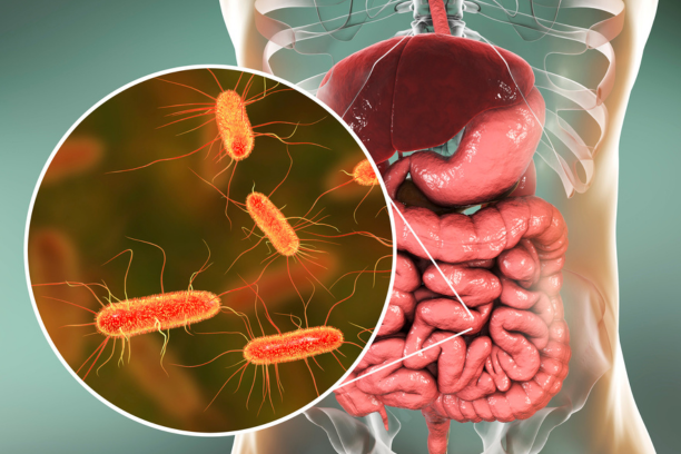 The Impact of Gut Microbiota on Systemic Inflammation and Joint Health