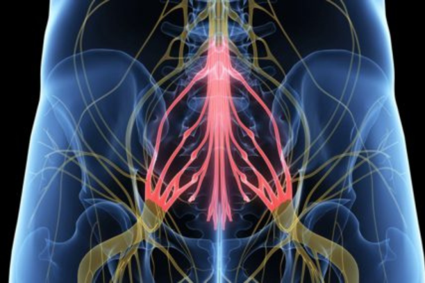 Cauda Equina Syndrome Symptoms in Post-Surgical Patients